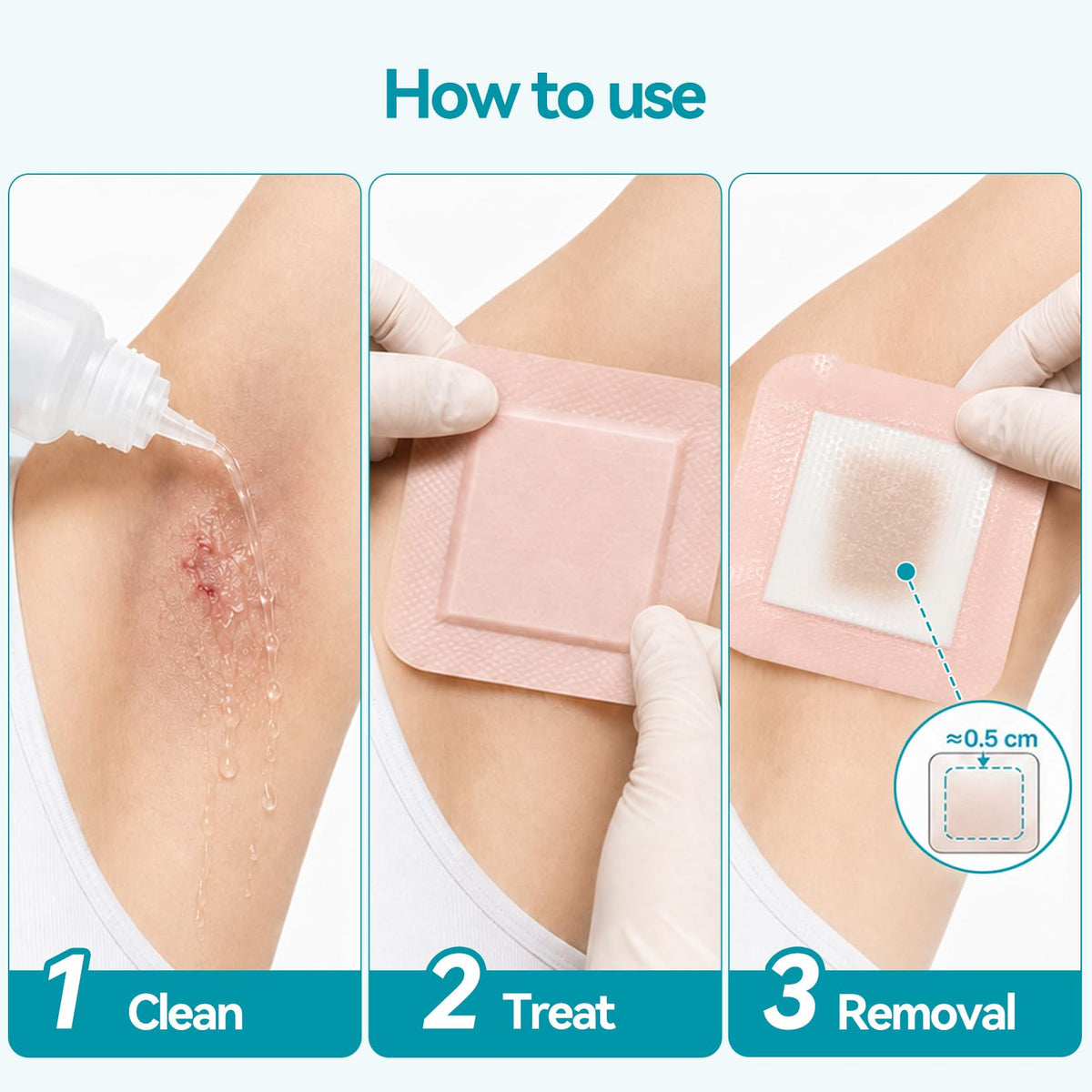 Dimora Silicone Foam Dressing 4"x4" Hidradenitis Suppurativa Pads (101 291) (Pack of 10)