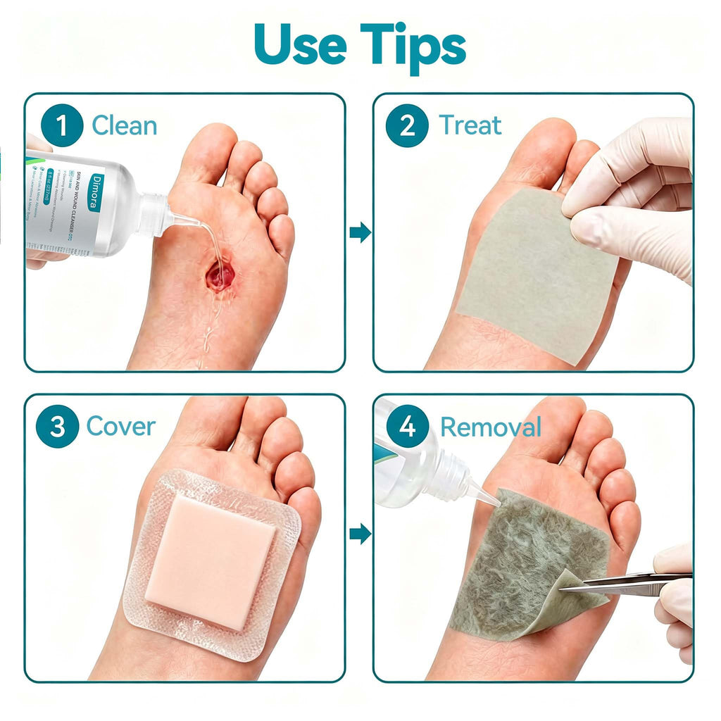 Dimora Alginate Wound Dressing -Silver-Infused Alginate