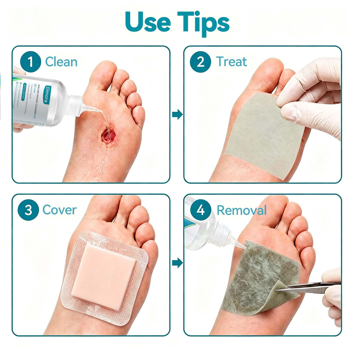 Dimora Alginate Wound Dressing -Silver-Infused Alginate